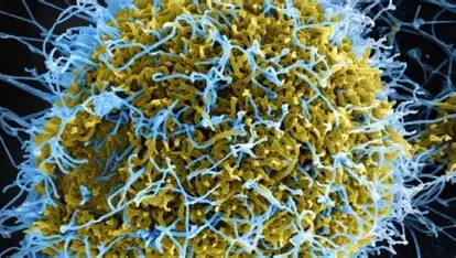 Nigeria on Alert as Ebola Outbreak Spreads in Central Africa